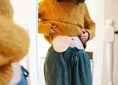 Ileostomy vs Colostomy