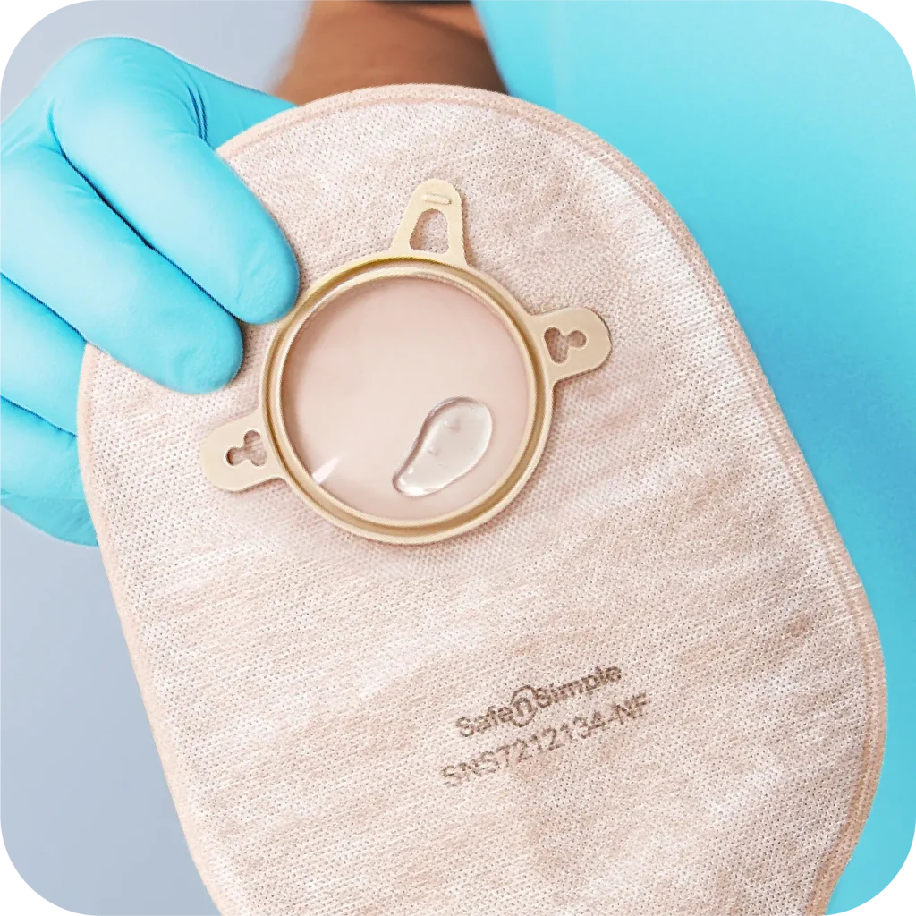 Ostomy Steps 4. Assure