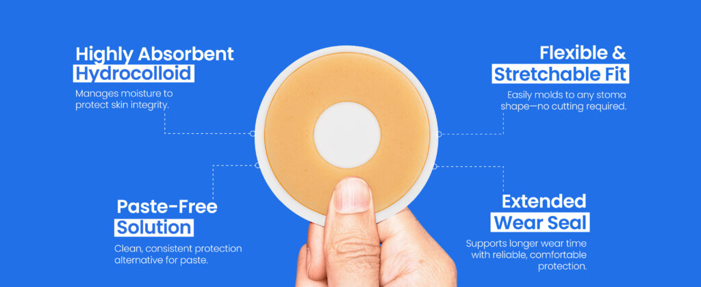 Barrier Ring vs Ostomy Paste