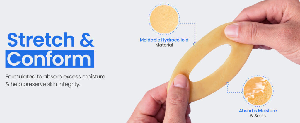 How to Use an Ostomy Barrier Ring